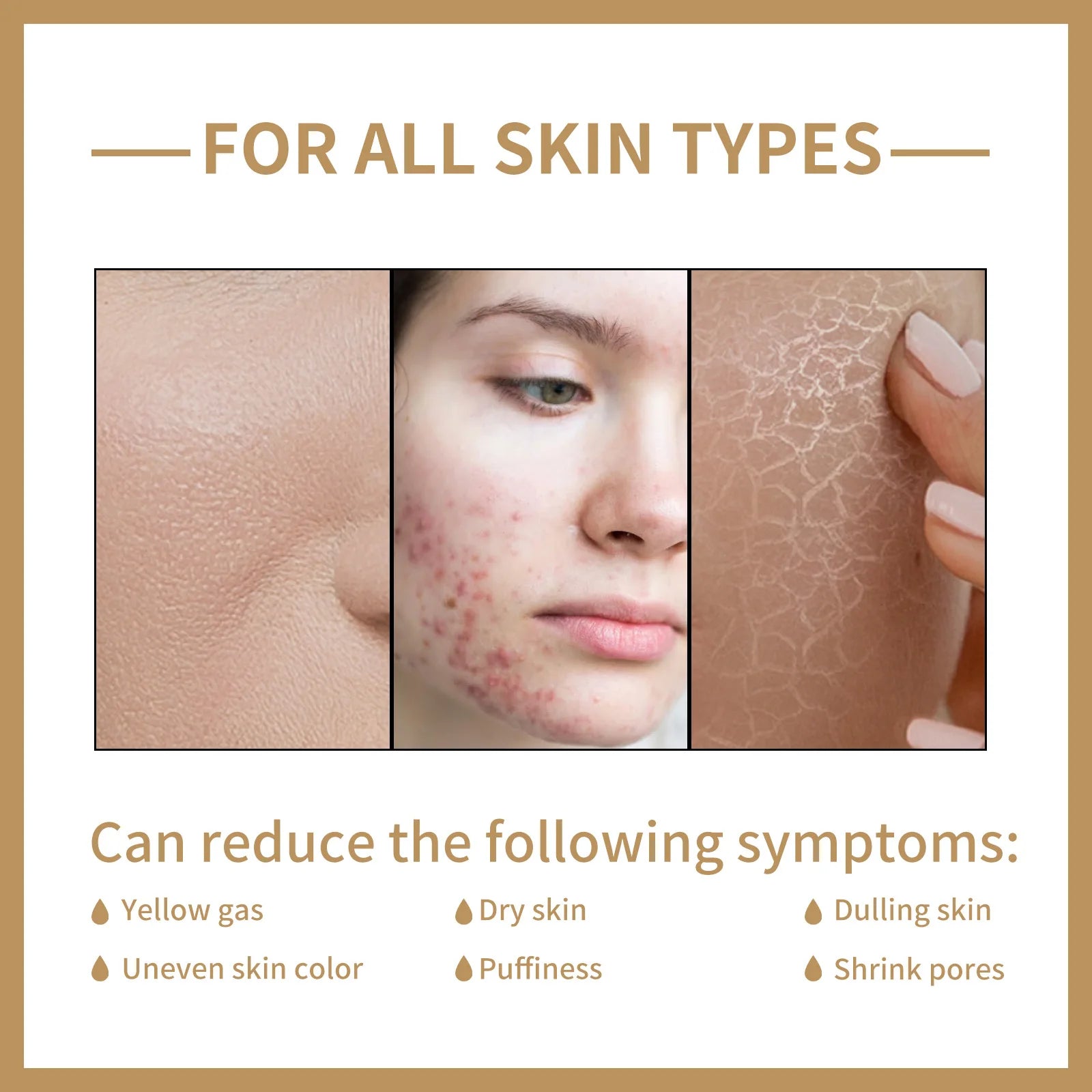 EELHOE Rice Water Toner – Hydrating & Pore-Refining Facial Toner (150ml)