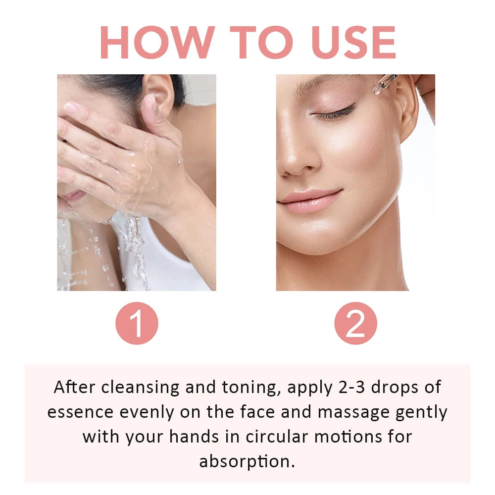 30ml Niacinamide Dark Spot Serum