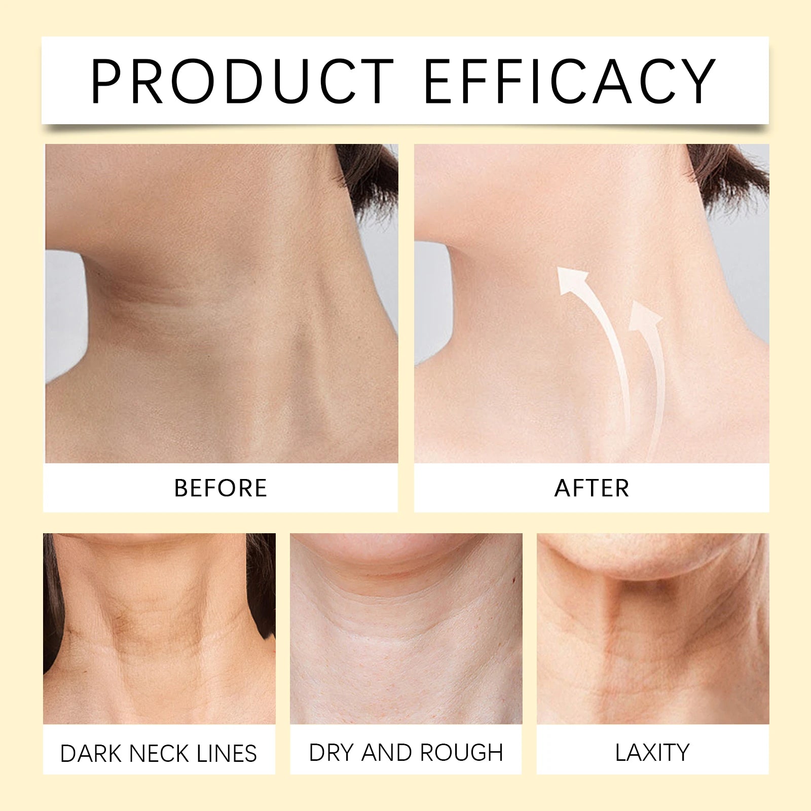 Bee Venom Neck Stick – Collagen Lifting & Double Chin Tightening Cream