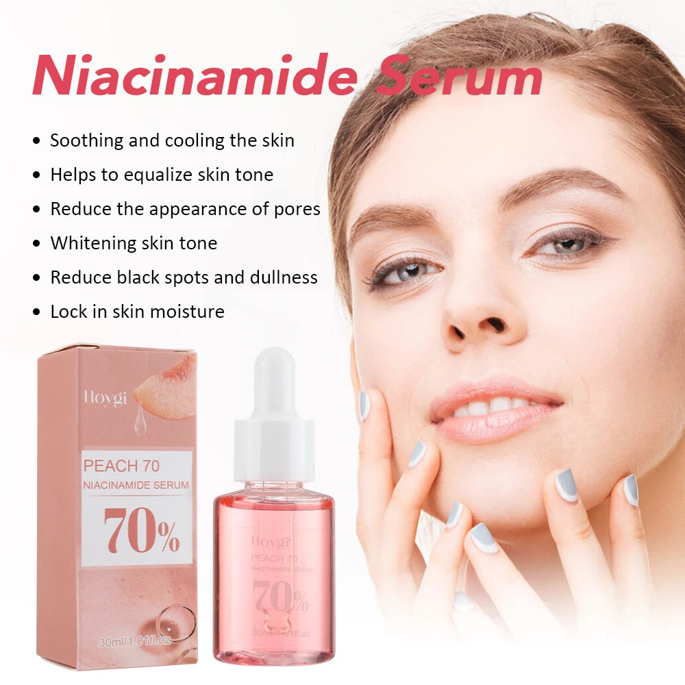 30ml Niacinamide Dark Spot Serum