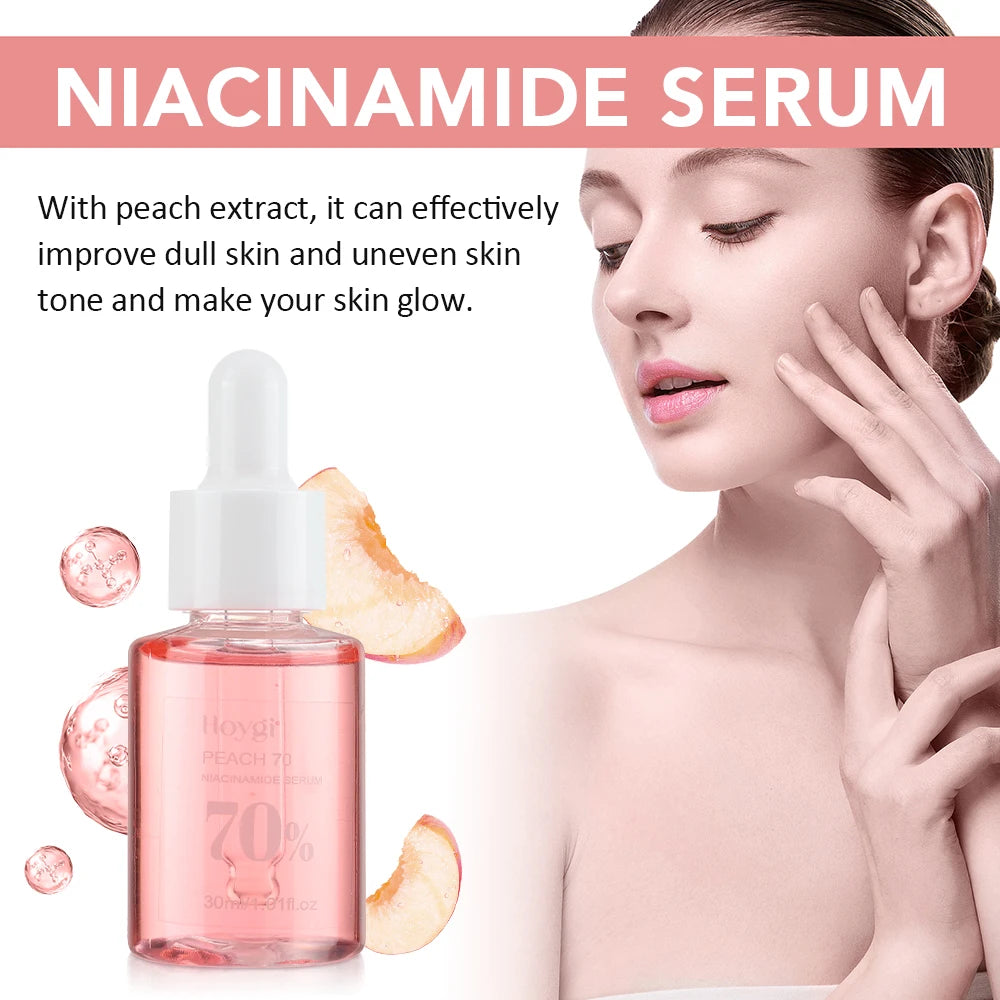 30ml Niacinamide Dark Spot Serum