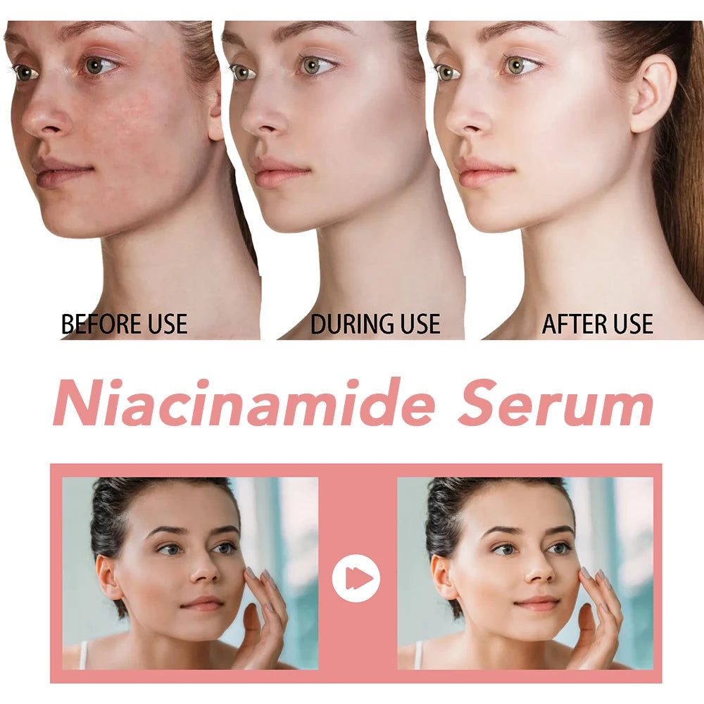 30ml Niacinamide Dark Spot Serum