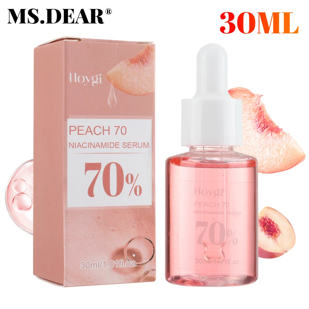 30ml Niacinamide Dark Spot Serum