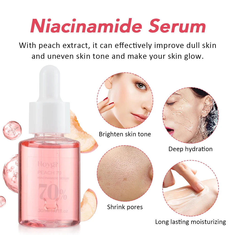 30ml Niacinamide Dark Spot Serum